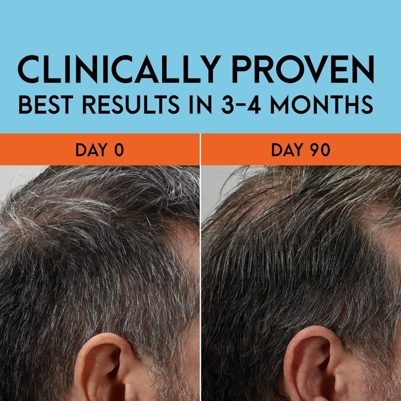 Gray Reverse Daily Hair Serum - Dye-Free Hair Color Restoration, 1.7oz, Pack of 3