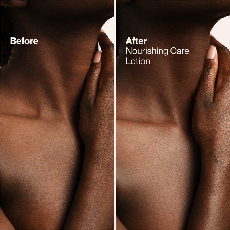 Nourishing Care Hand & Body Lotion with Shea Butter for Dry Skin