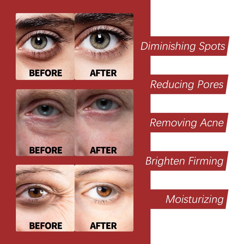 Retinol Night Cream Moisturizer for Anti-Aging & Hydration