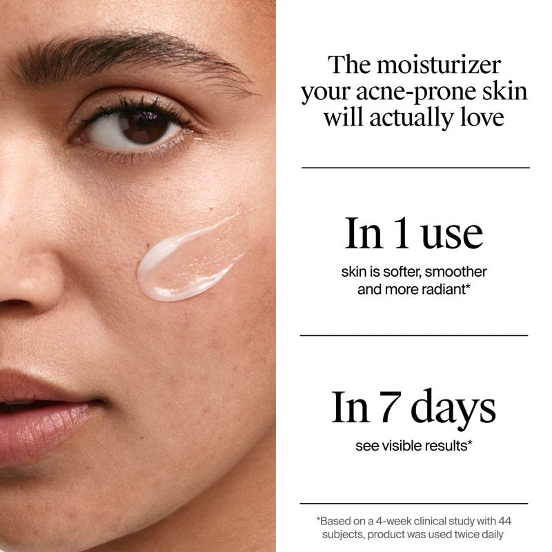 Acne Treatment Gel Moisturizer with Salicylic Acid, 1.7 fl. oz