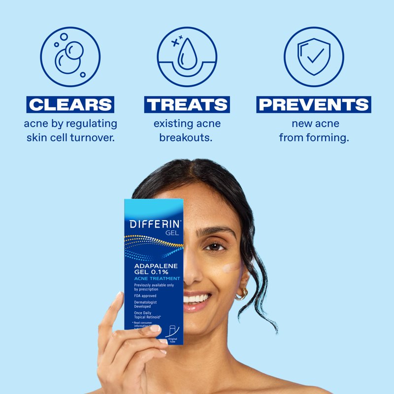 Adapalene 0.1% Acne Treatment Gel - Prescription Strength Formula, 1.6 oz