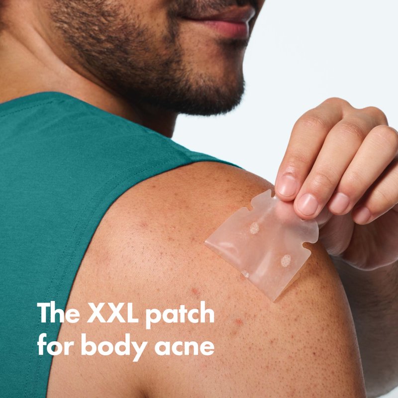 Hydrocolloid Body Acne Patch for XL Breakouts, 4 Count