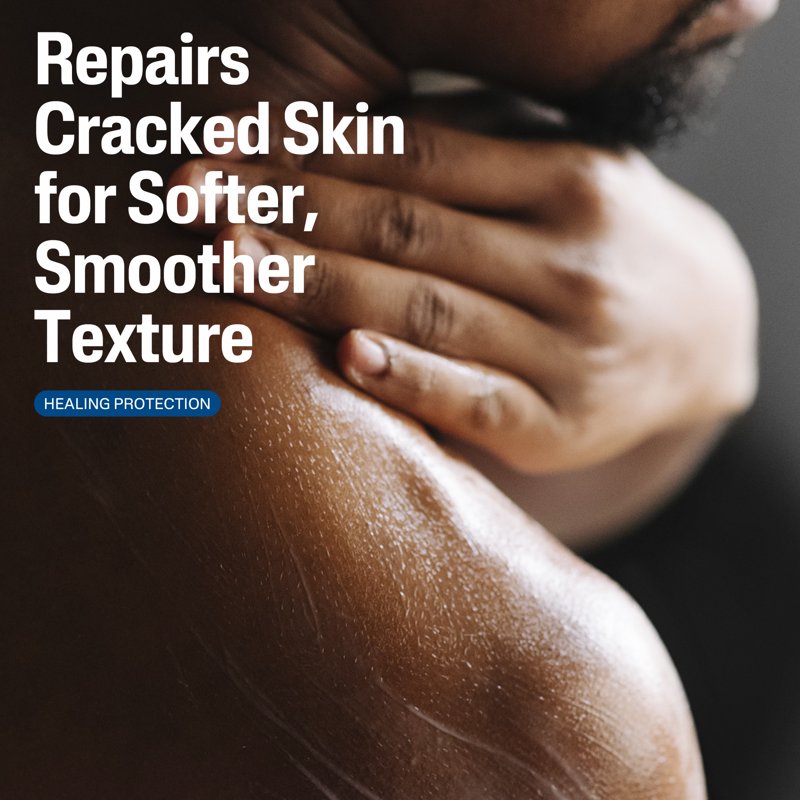 Skin Repair Lotion for Very Rough Cracked Skin - Unscented 16 fl oz