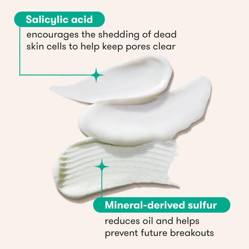 3-Step Acne Clearing Skincare Routine with Mineral Cleanser and Azelaic Acid