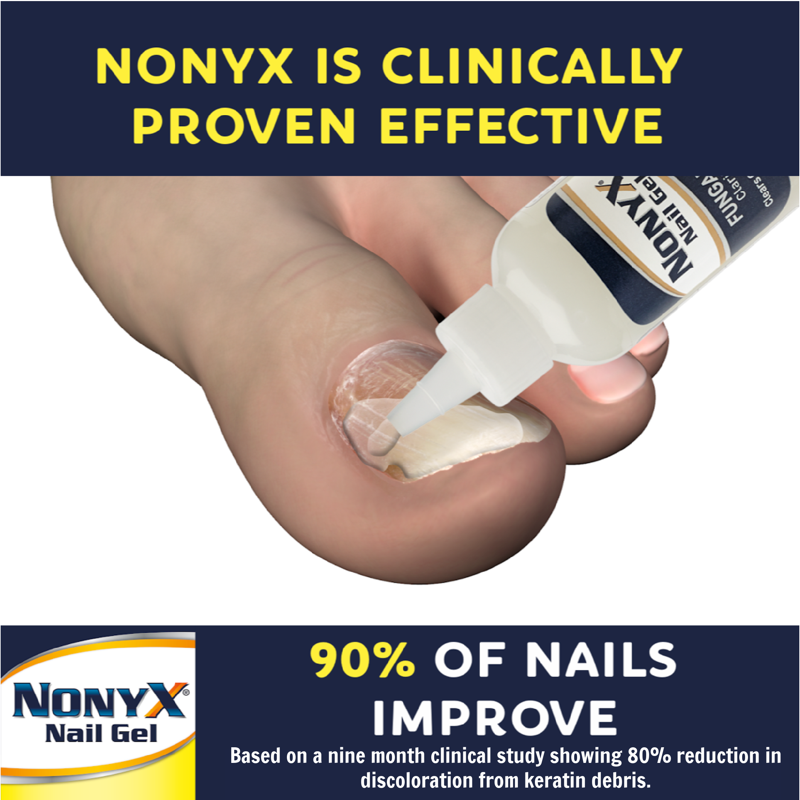 Nail Clarifying Gel for Fungus-Damaged Nails - Topical Keratin Debris Remover