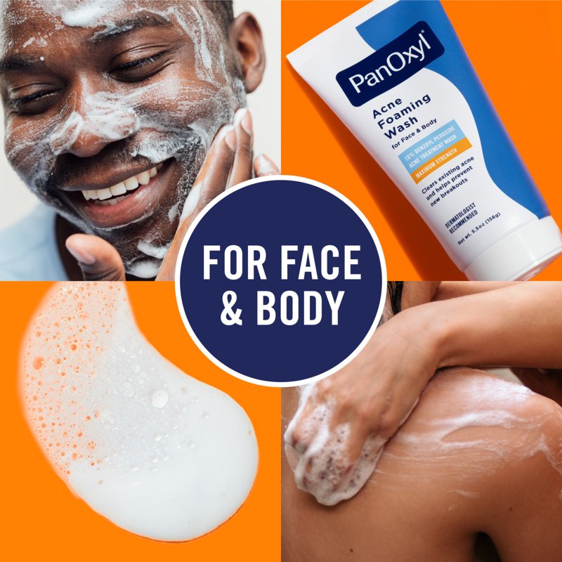 Maximum Strength Acne Foaming Wash with 10% Benzoyl Peroxide - Multipack
