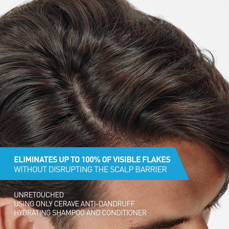 Hydrating Anti-Dandruff Conditioner for Itchy Scalp, 9 fl oz