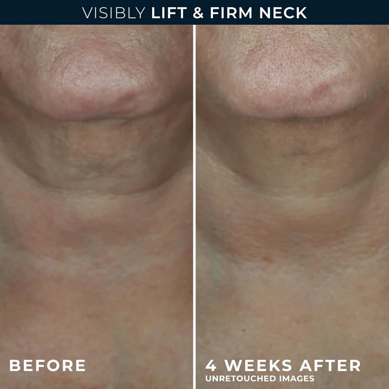 Firming Face and Neck Contour Cream with Retinol and Hyaluronic Acid 1.7 oz
