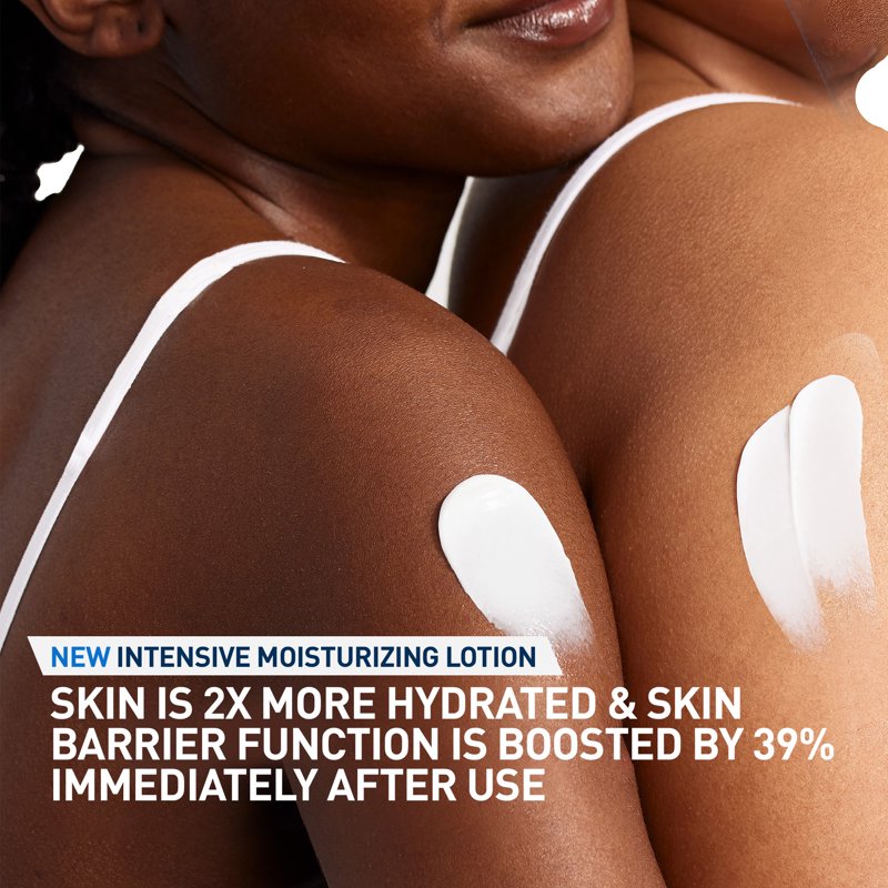 Intensive Moisturizing Body Lotion for Dry to Very Dry Itchy Skin