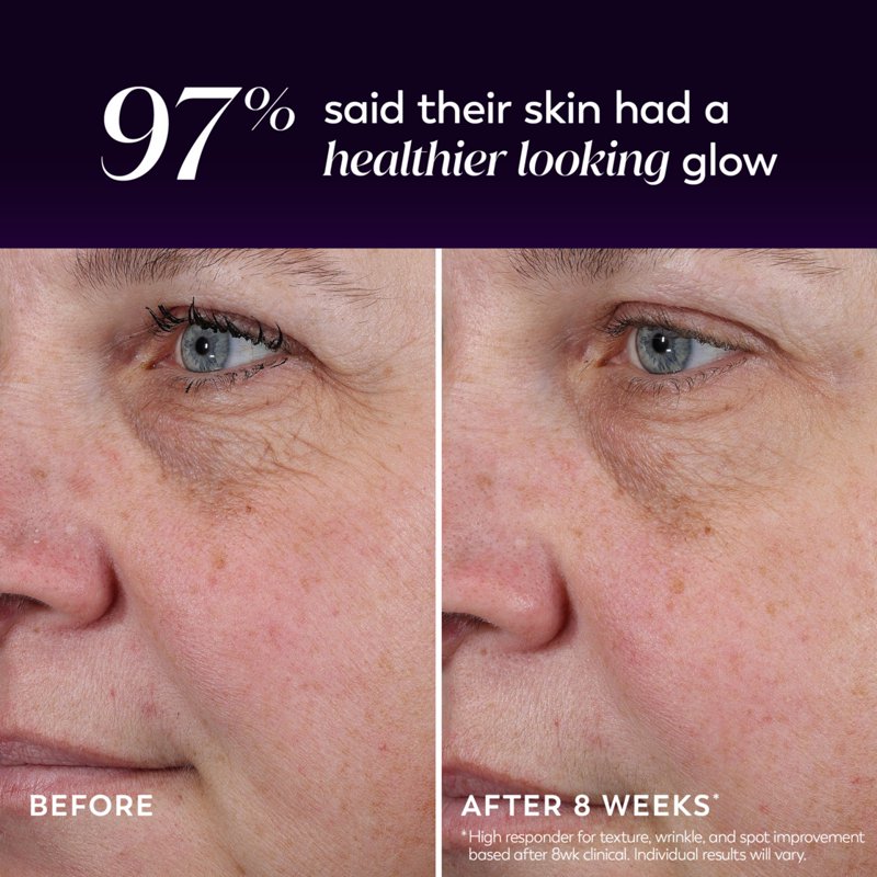 Night Resurfacing Peel Treatment Serum with AHA and Peptides, 30mL