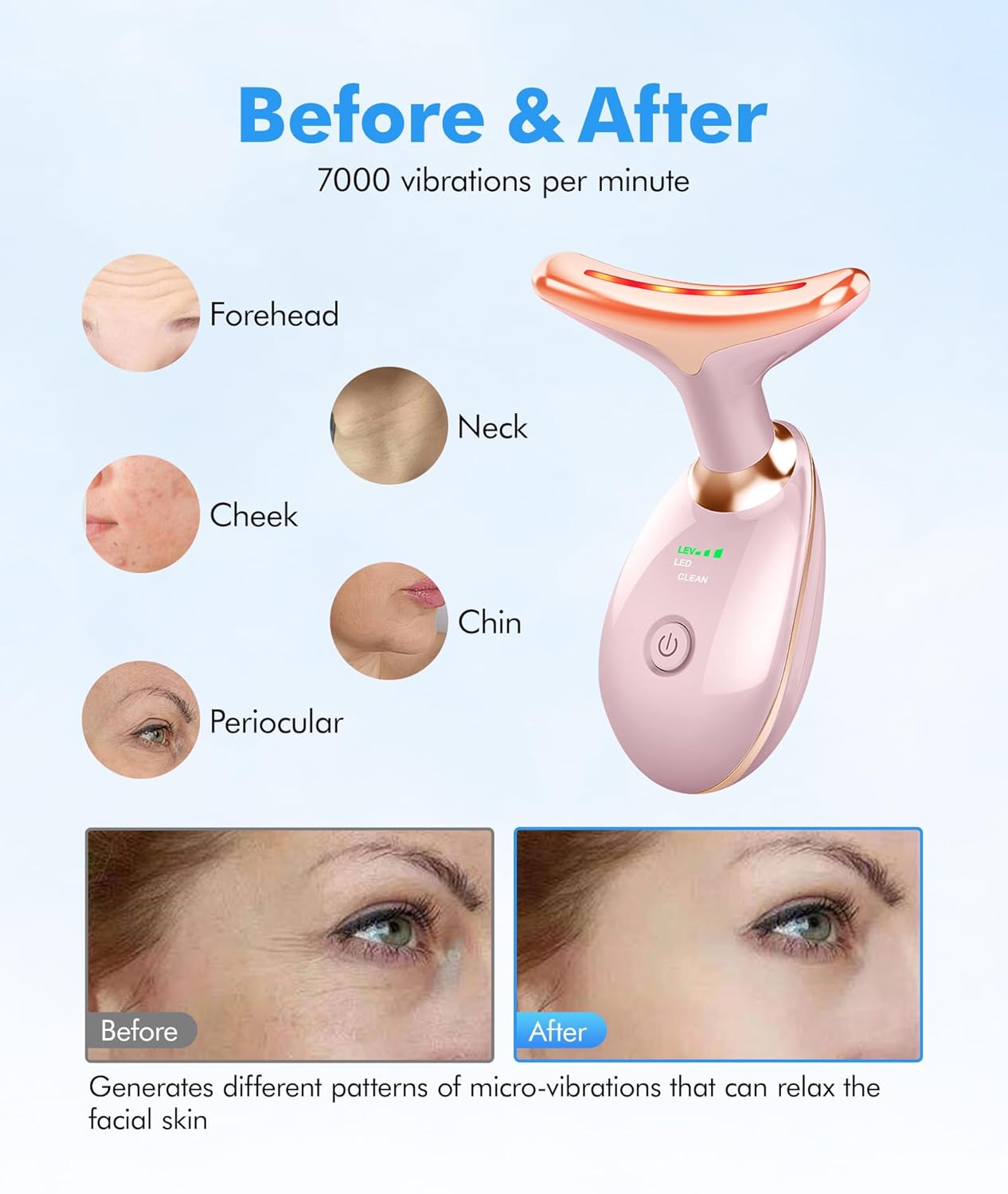Skiennix Red Light Therapy Face Massager - 7 Color Vibrating Tool for Wrinkles & Double Chin | Glossy Pink