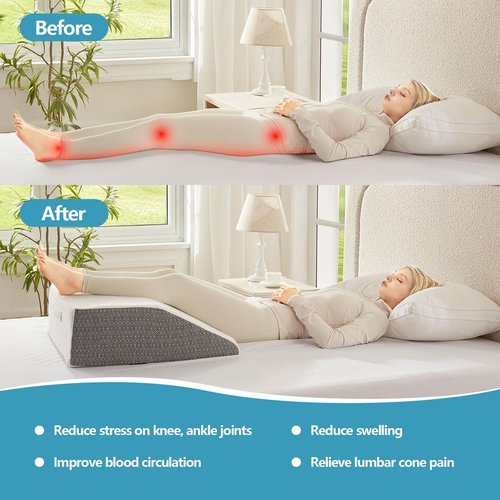 Nordjager Leg Pillow for Elevation & Support, 24"x22"x10" Memory Foam Cushion with Grey White Patterned Polyester Cover, Ideal for Improving Circulation & Relaxing Leg