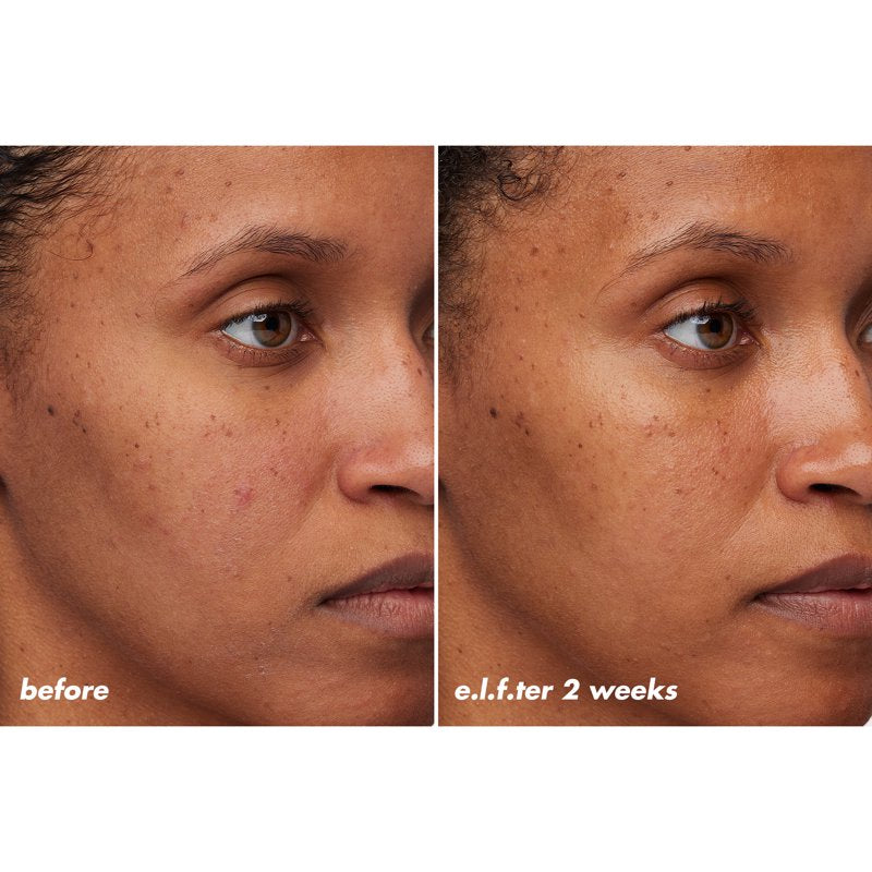 Barrier Repair Face Cream with Colloidal Oatmeal & Hyaluronic Acid, 2.1oz