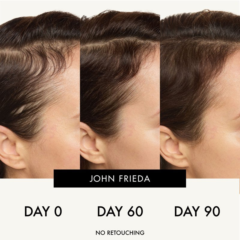 Hair Thickening Serum for Fine Hair - ULTRAfiller+ Scalp Serum