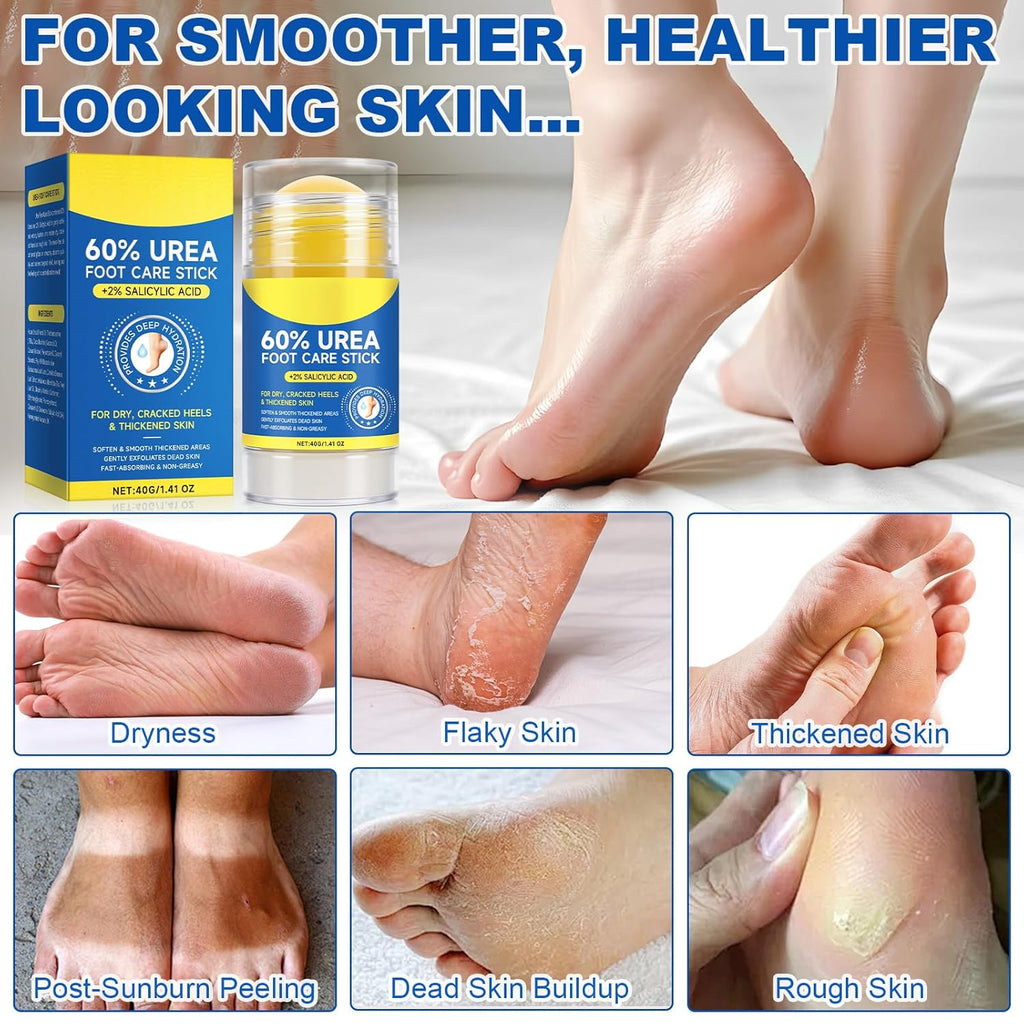 Regine Switzerland Urea Cream Stick - Maximum Strength Exfoliating Foot Balm with 2% Salicylic Acid | 1.4oz