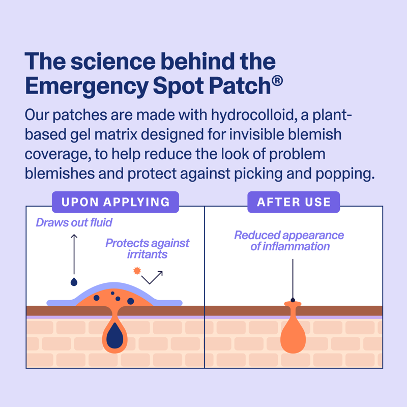 Hydrocolloid Pimple Patches - Emergency Spot Treatment, 40 Count