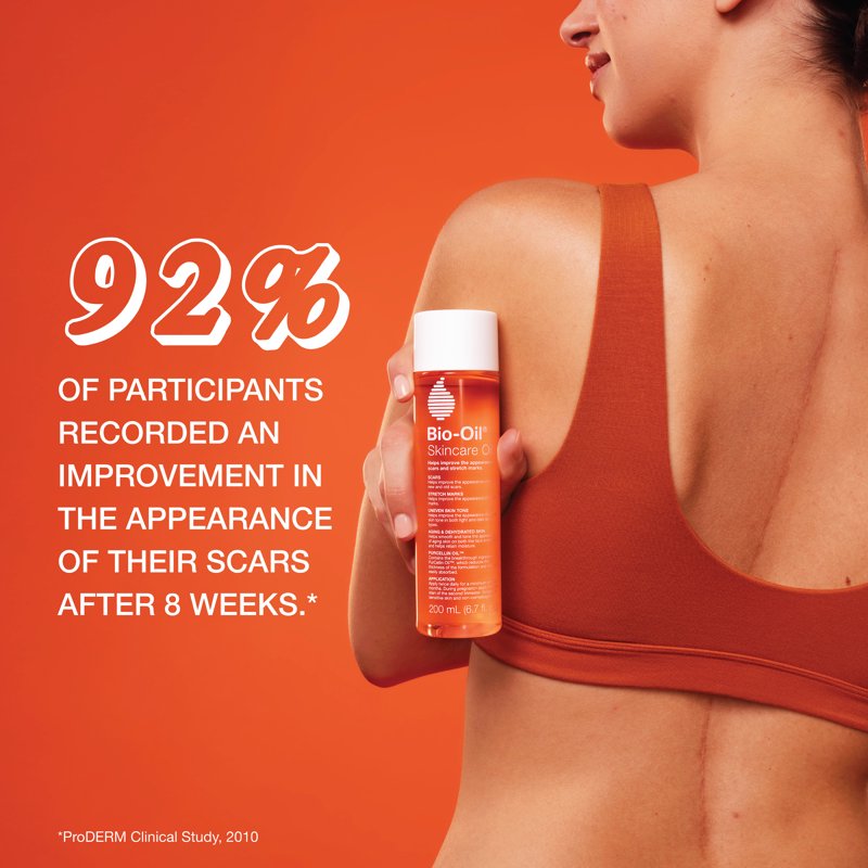 Hydrating Body Oil for Scars & Stretch Marks - 0.85 fl oz