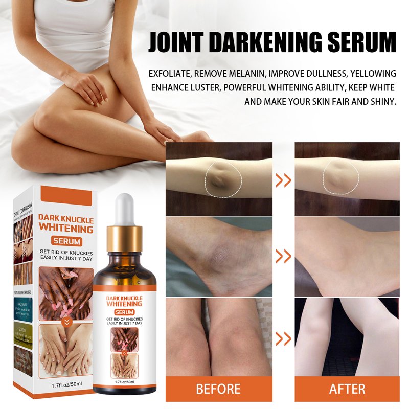 Dark Spot Corrector Serum for Hands & Body - 1.7 fl oz