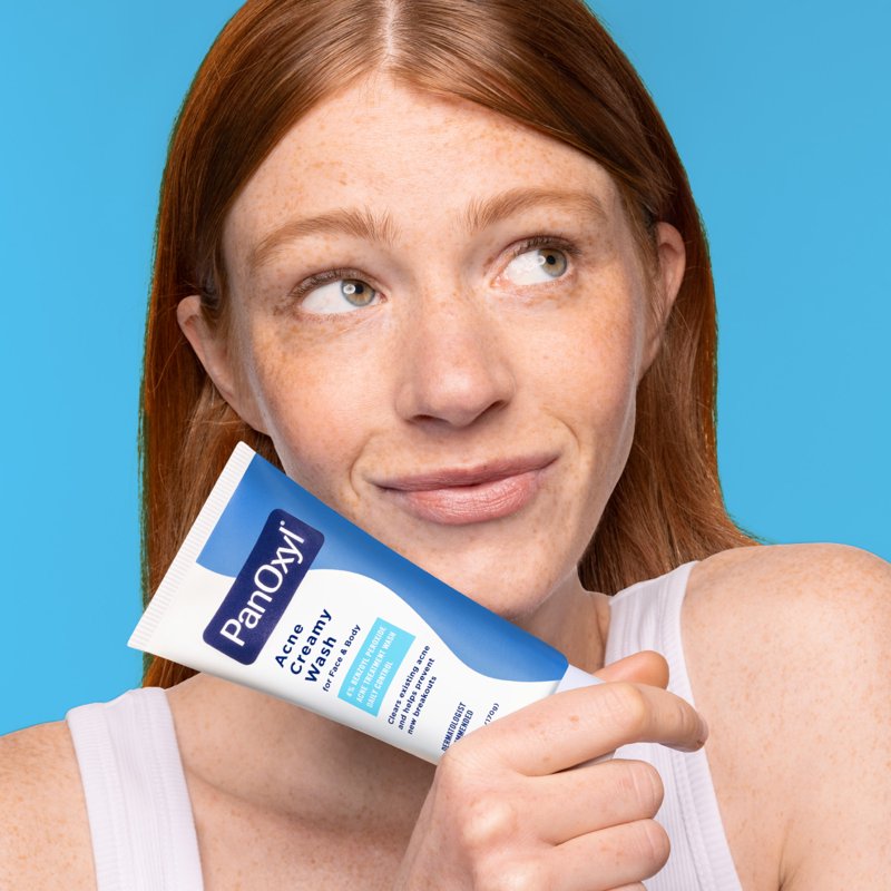 4% Benzoyl Peroxide Acne Creamy Wash - Face and Body Cleanser, 6 oz