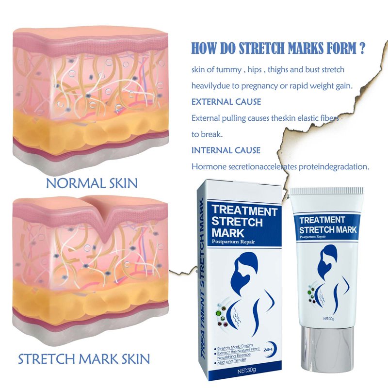 Stretch Mark Cream for Pregnancy & Postpartum - Skin Firming Lotion, 1.05 oz