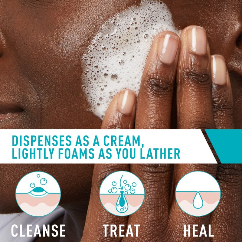 Acne Foaming Cream Cleanser with 4% Benzoyl Peroxide & Hyaluronic Acid 5oz