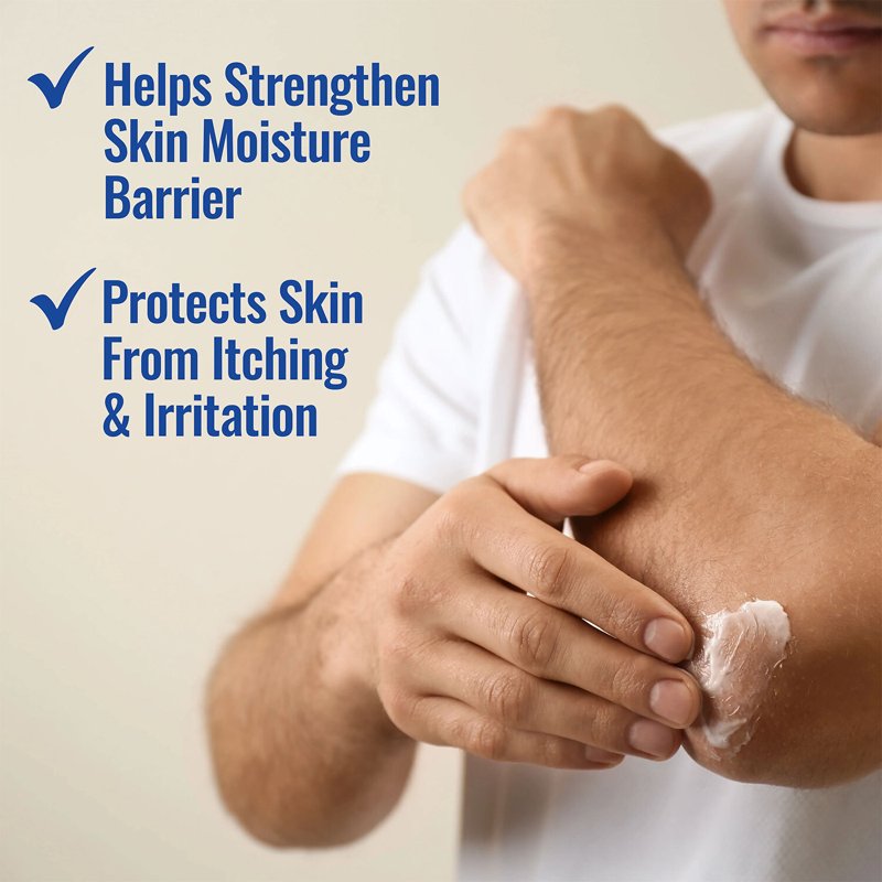 Nizoral Eczema Relief Cream- Relieves Dry, Itchy, Irritated Skin,
