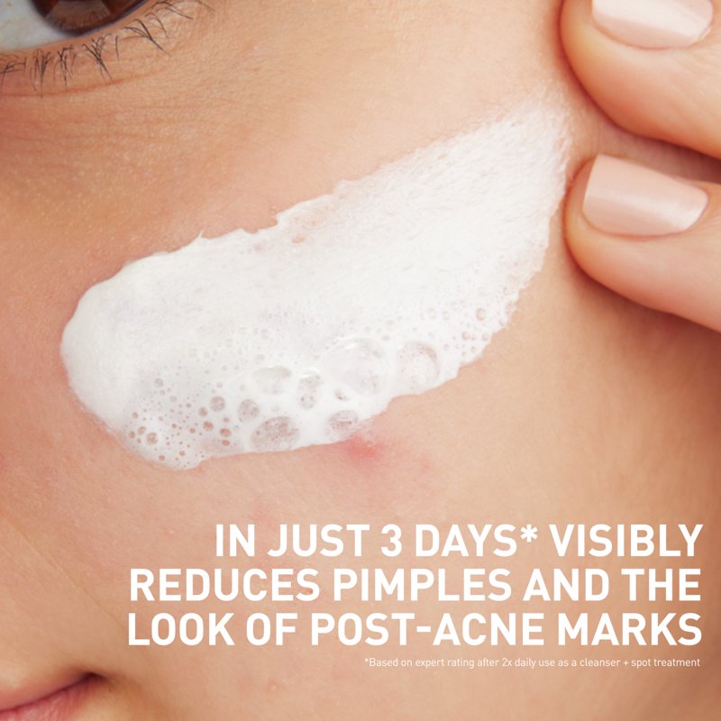 3-in-1 Acne Clay-to-Foam Facial Cleanser with 2% Salicylic Acid, 2-Pack