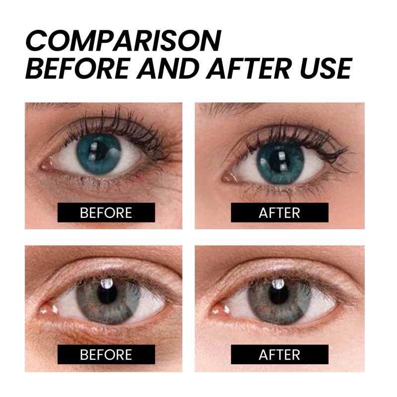 Instant Eye Tightener Cream - Reduces Puffiness & Dark Circles