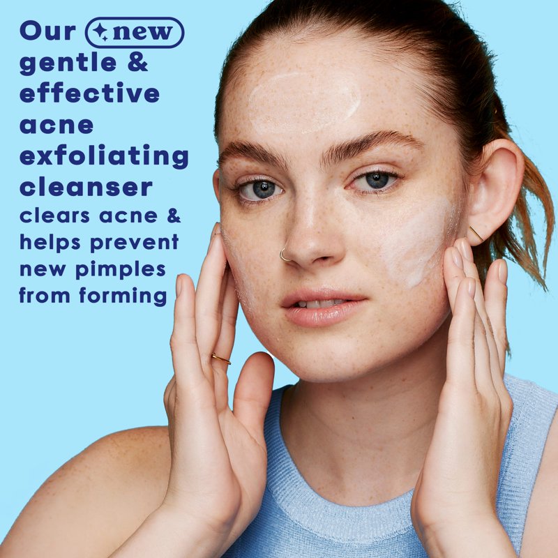 Salicylic Acid Exfoliating Facial Scrub for Acne-Prone Skin, 5 oz