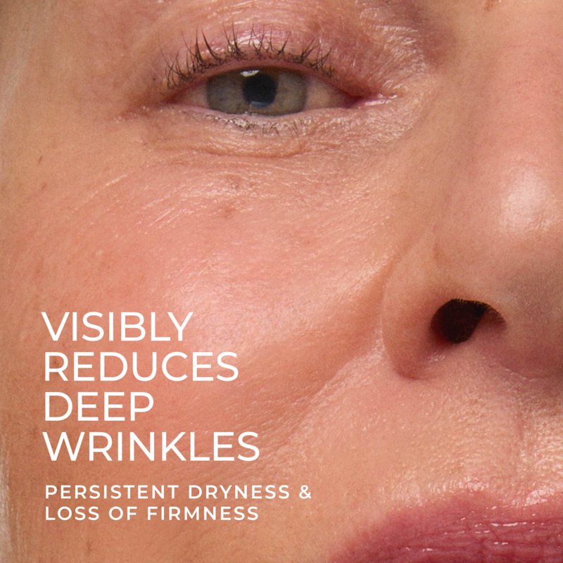 Retinol Deep Wrinkle Night Cream with Hyaluronic Acid - 1.7 oz