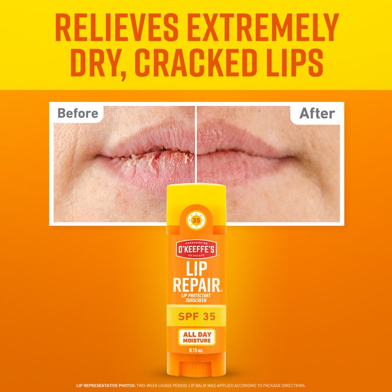 Lip Repair SPF 35 Balm - Healing Moisturizer for Dry Lips, 3-Pack