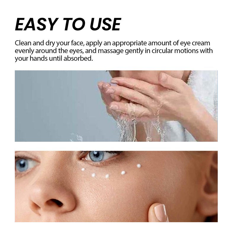 Eye Tightener Cream - Reduces Dark Circles & Puffiness