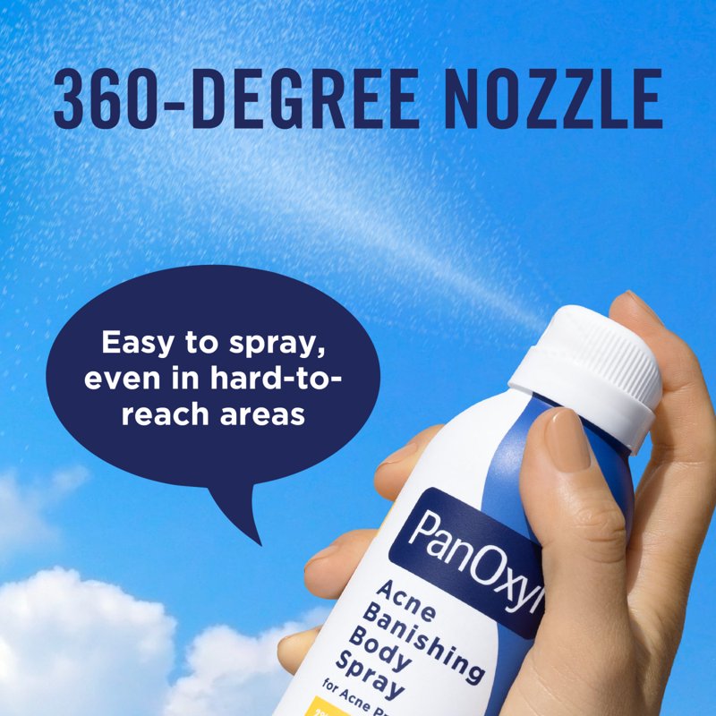 2% Salicylic Acid Acne Body Spray for Clear Skin, 6 oz