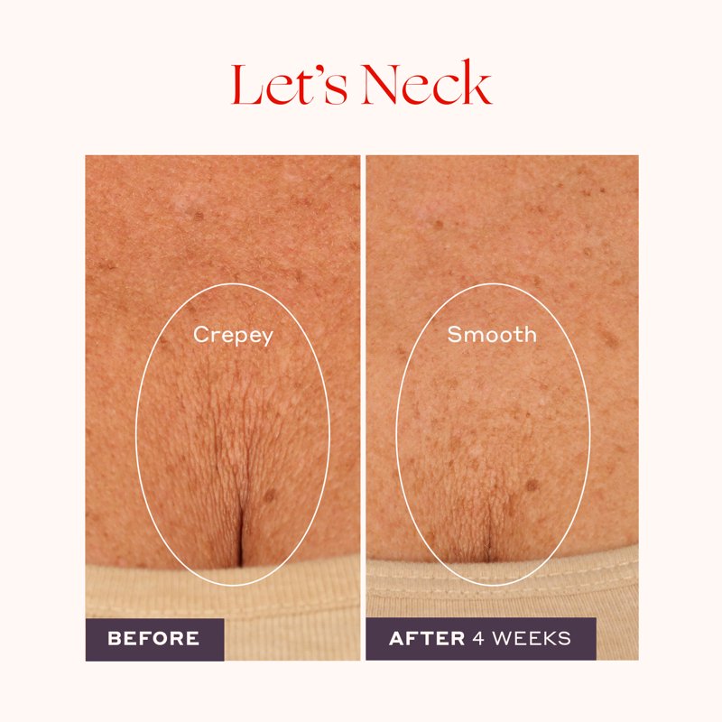 Firming Neck and Decollete Serum with Roller Applicator, 1.7 fl oz