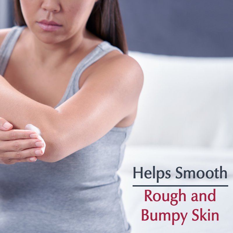 Roughness Smoothing Body Cream for Dry and Bumpy Skin - 16 oz