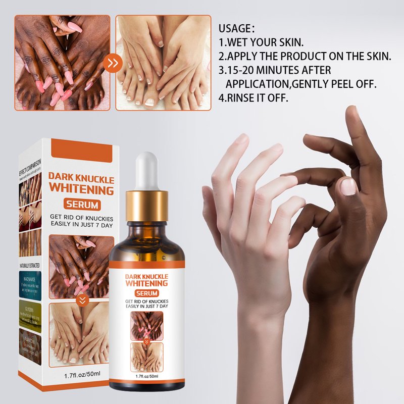 Dark Spot Corrector Serum for Hands & Body - 1.7 fl oz