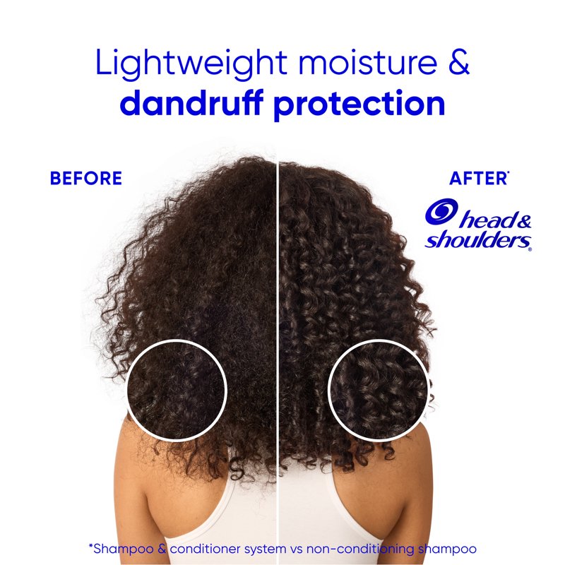 Coconut Dandruff Conditioner for Hydration & Flake Control - 10.9 fl oz