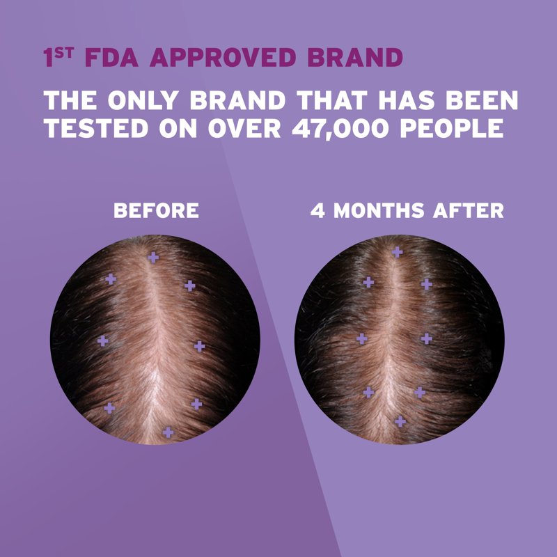 Women's Hair Regrowth Treatment with 2% Minoxidil Solution - 1-Month Supply