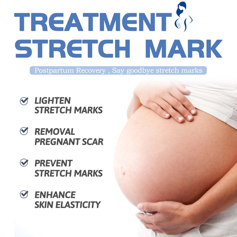 Stretch Mark Cream for Pregnancy & Postpartum - Skin Firming Lotion, 1.05 oz
