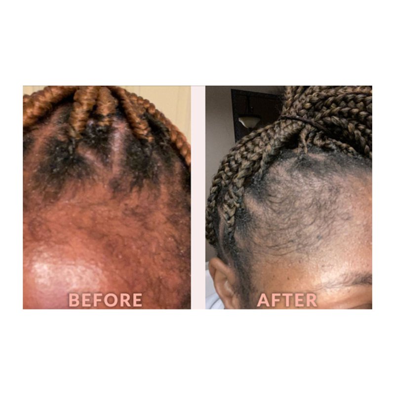 Edge & Temple Strengthening Hair Oil - 4oz, All Hair Types
