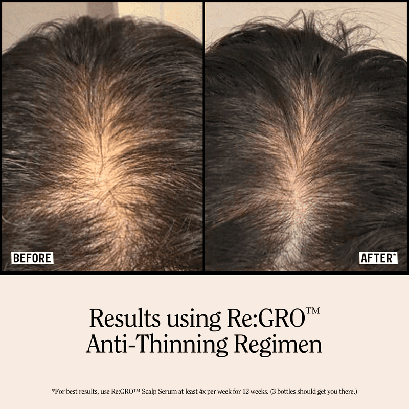 Anti-Thinning Conditioner with Biotin - 16.5 fl oz