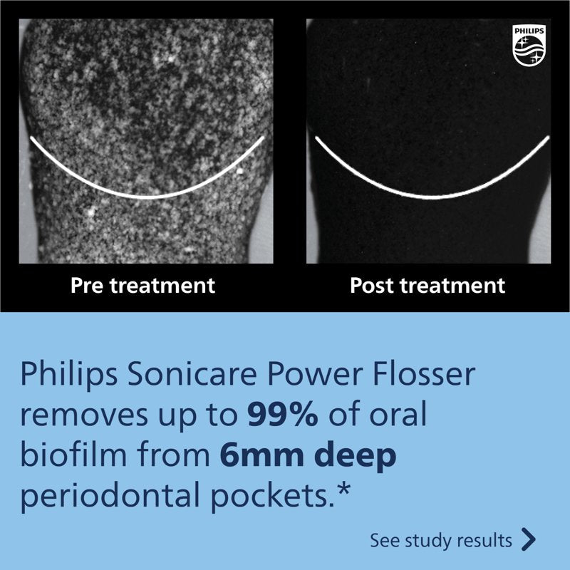 Philips Sonicare Power Flosser 3000 - Quad-Stream Technology