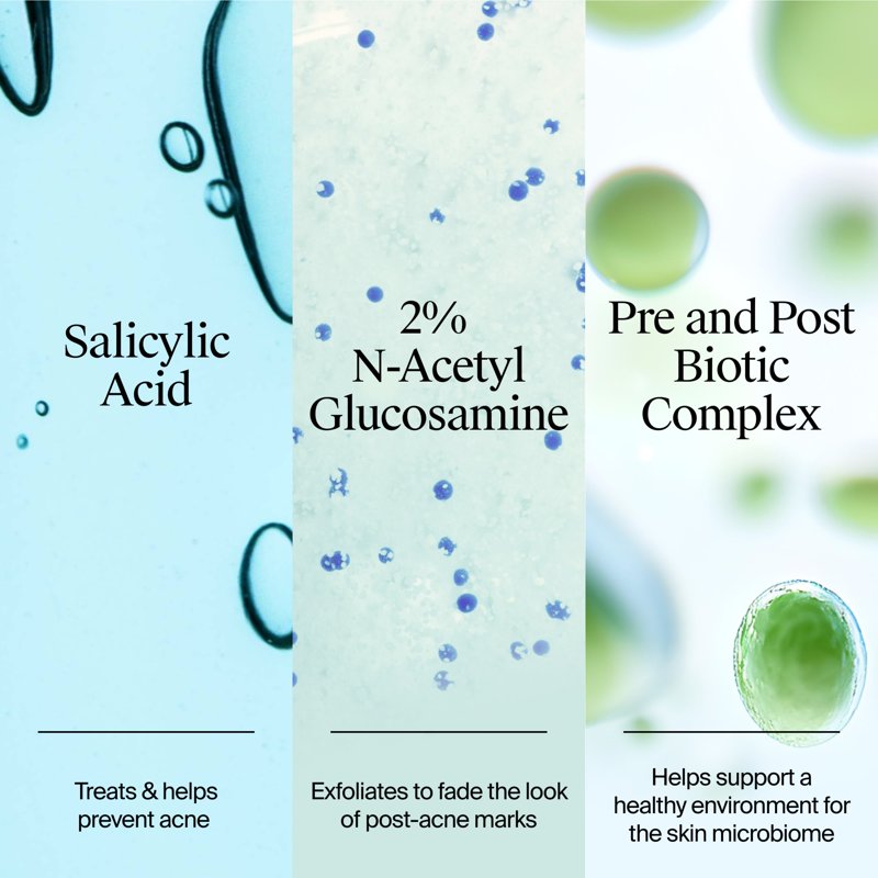Acne Treatment Gel Moisturizer with Salicylic Acid, 1.7 fl. oz
