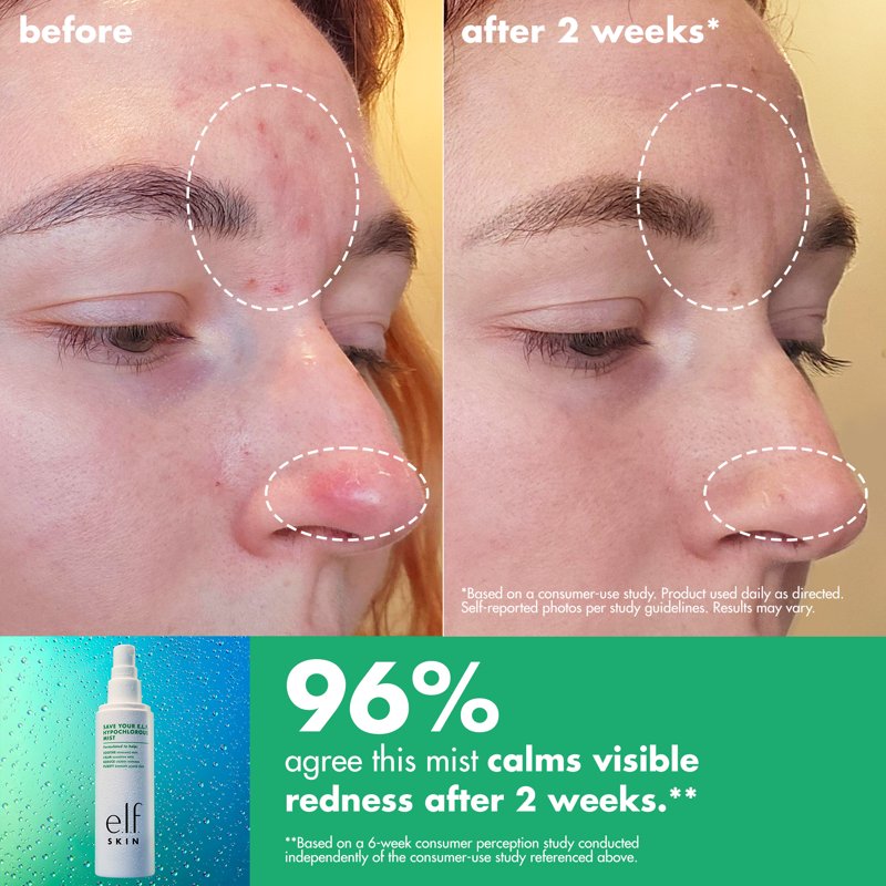 Hypochlorous Acid Facial Mist - Soothing Spray for Sensitive Skin, 3.38 fl. oz.