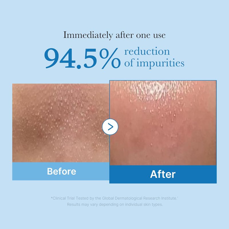 Deep Cleansing Oil for Blackheads & Pores - 6.93 fl oz