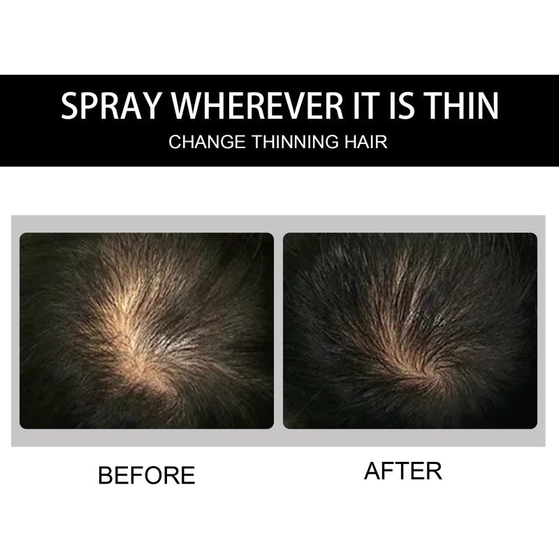Hair Building Fibers Powder for Thinning Hair - Black 0.42oz
