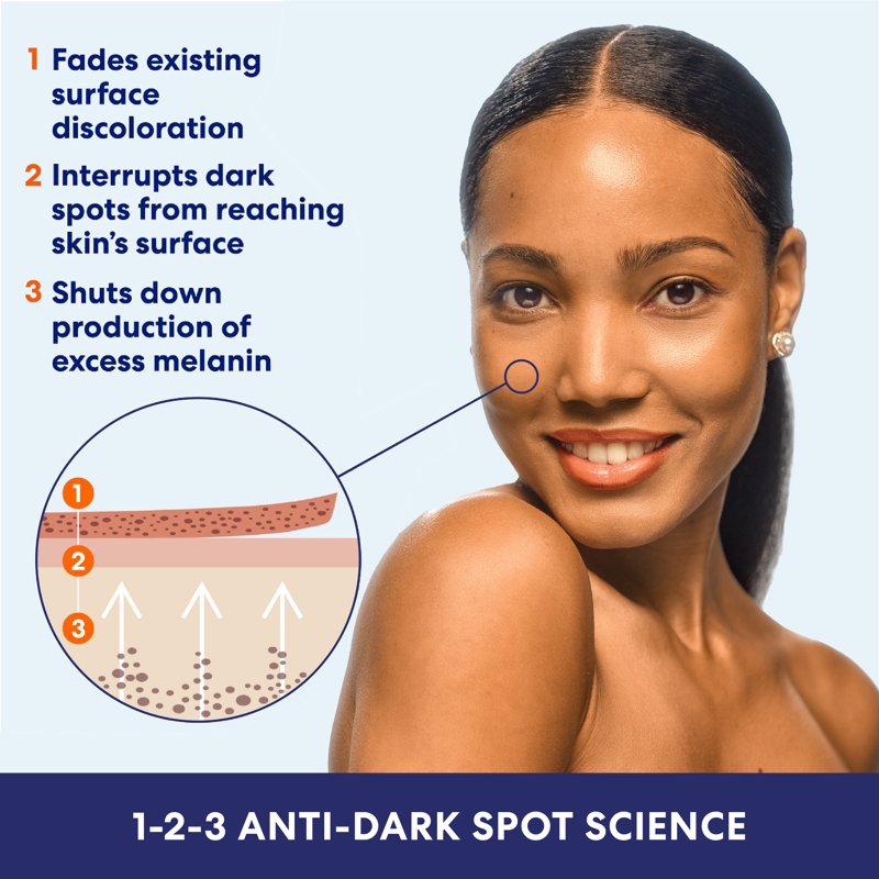 Anti-Dark Spot Fade Body Lotion for Uneven Skin Tone - 8.5 fl. oz.